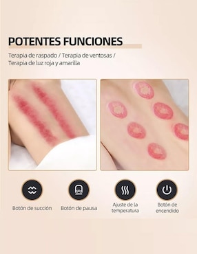 Ventosa de succión